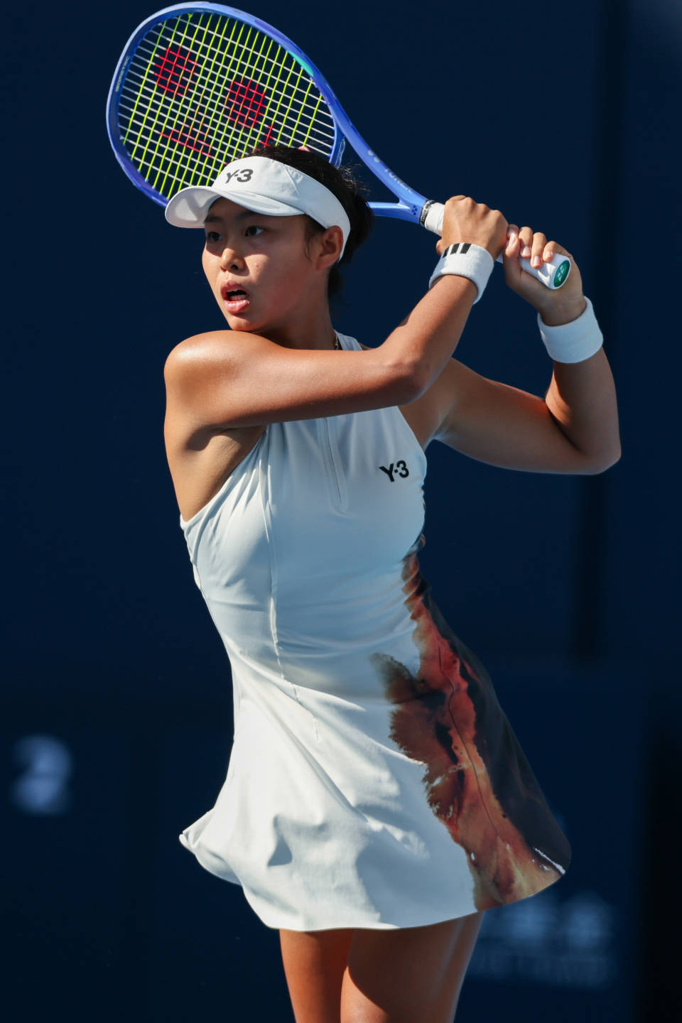 局后, 张瑞恩职业, 获得了